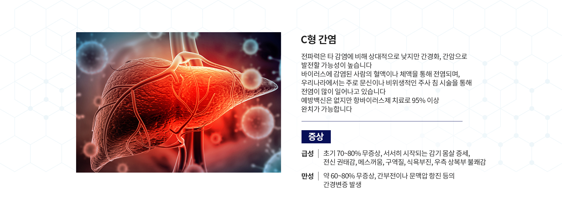 간염 클리닉 증상