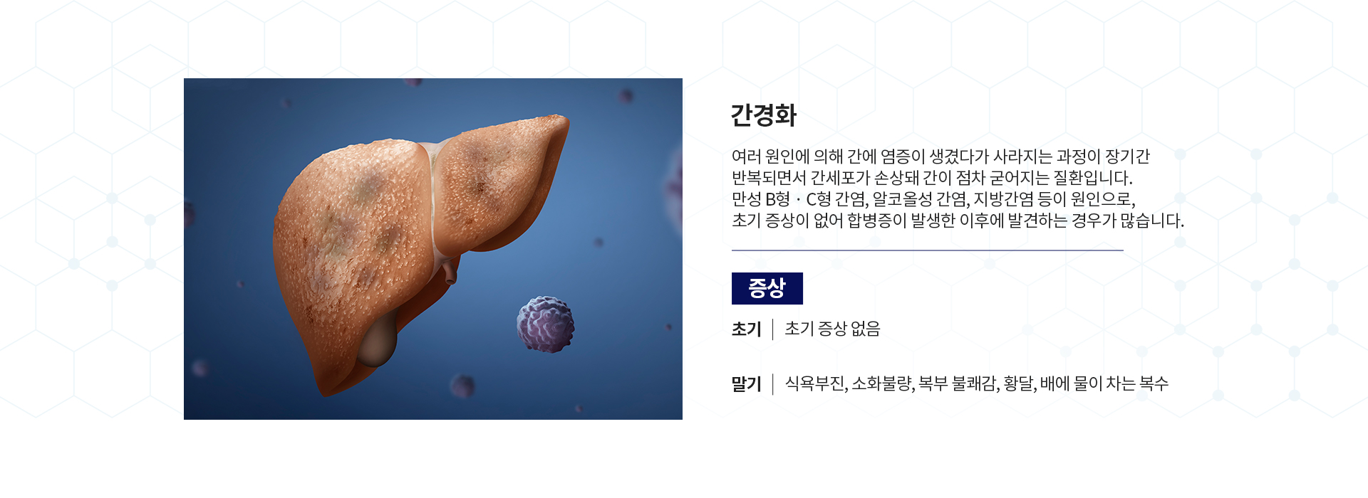 간염 클리닉 증상