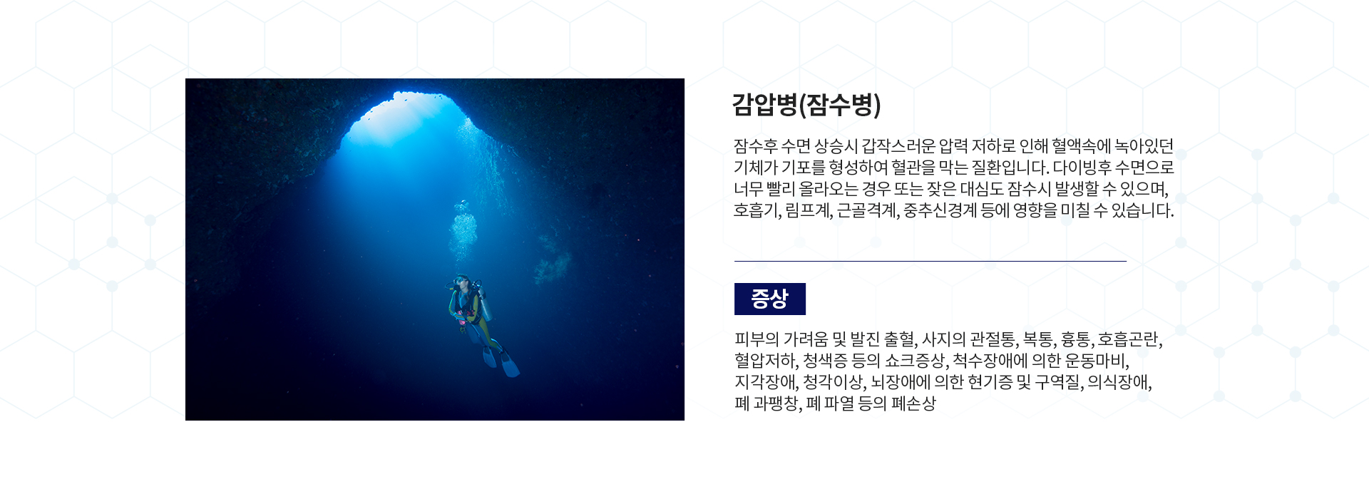 트수 클리닉 증상